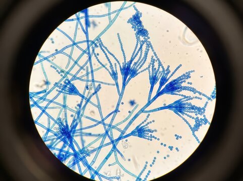 Penicillium Mold Hyphae And Conidia Light Micrograph Showing Fungal Spore Chains And Mycelium Structure For Mycology And Pharmaceutical Research   