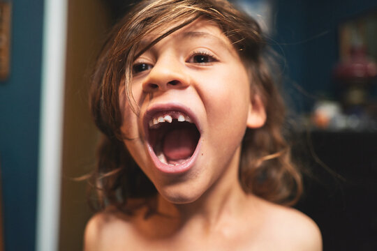 Boy With Missing Baby Teeth and Mouth Wide Open
