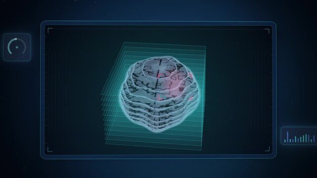 AI brain MRI slice stack in cyan on dark blue seamless loop