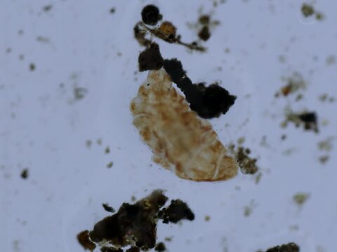 Tardigrade waking up from the tun state