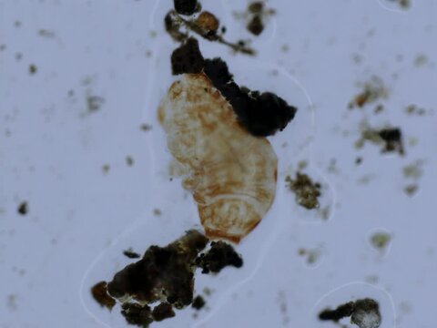 A tardigrade drying out and entering the tun state
