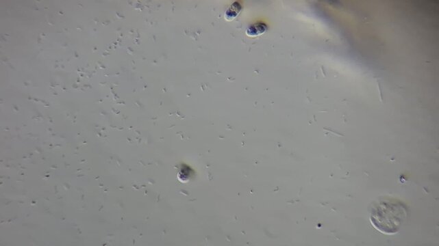 Microscopic view of bacteria and microorganisms swimming in pond water, spirillum and bacilli, 600x magnification