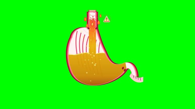Medical 2D flat animation loop of human stomach showing GERD acid reflux disease, gastric hyperacidity surging into esophagus, and burning heartburn pain isolated on chroma key green screen.