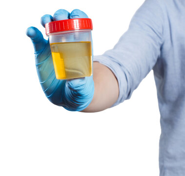 Gloved healthcare worker presenting urine specimen cup for analysis, isolated on transparent cutout background