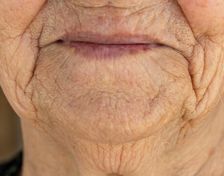 Close-up of elderly woman's lips and surrounding skin