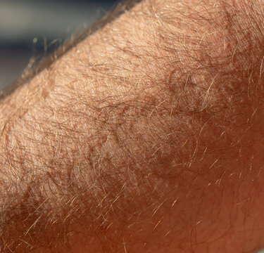 Close-up of human arm hair under natural light