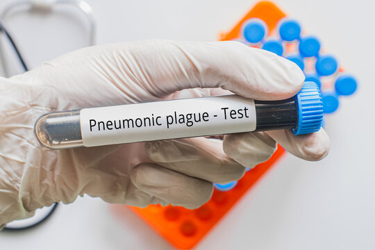 Gloved hand holding Pneumonic Plague labeled blood tube, infectious disease medical testing concept