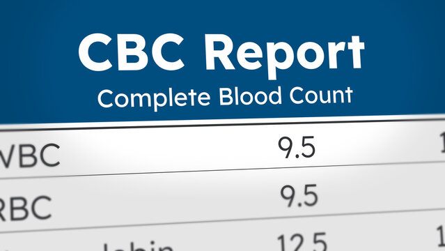 CBC test report, Blood test report, Complete blood count report result page with WBC, EBC, Hemoglobin, MCV. Blood sample report