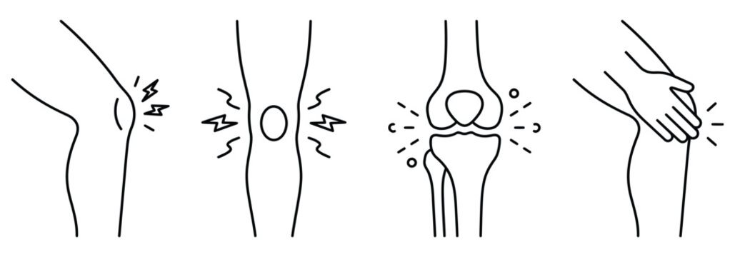 Human knee pain icons set featuring joint anatomy and inflammation symbols for medical diagnostics.