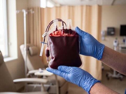 Bolsa de sangue cheia segurada por m&atilde;os com luvas, conceito de salvar vidas, fundo neutro