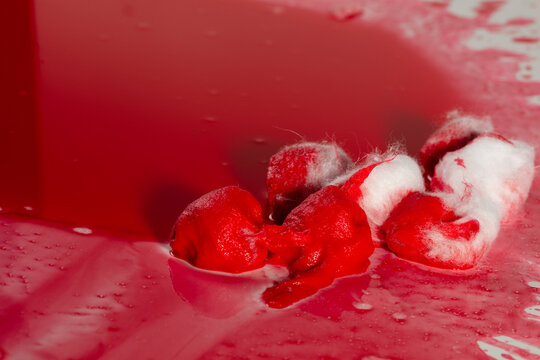 Medical round cottons soak with red blood from injury emergency pain. Dripping blood from group round cotton and droplet over white tray