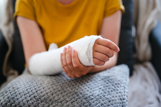 Closeup injured arm in cast resting on a pillow