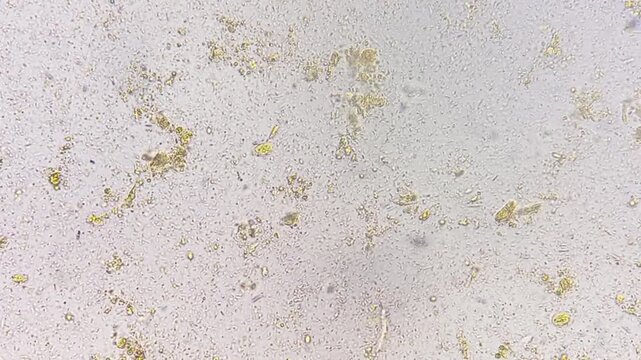 Microscopic footage of human feces or stool showing Cysts of giardia lamblia. Cysts of giardia lamblia and bacteria in stool. 