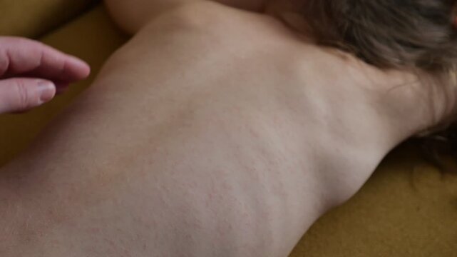 Gentle Hand Of Mother Caresses Tender Back Of Resting Child Showing Mild Allergy Rash. Compassionate Caregiver Monitors Irritated Pediatric Skin During Careful Soothing Routine Indoor.