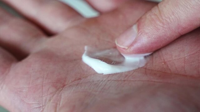 A man spreads white cream across his open palm with two fingers, the lotion smearing in a glossy streak over the skin creases. A close up for hand cream, moisturizer, dry skin care, ointment applicat
