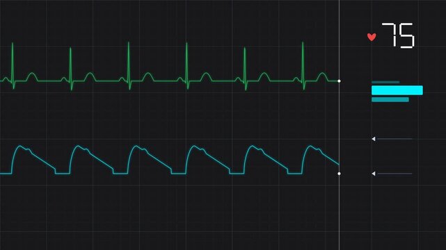 Medical Icu Bedside Telemetry Monitor Ecg and Abp Pulse Wave for High Precision Engineering and Robotics Technology System