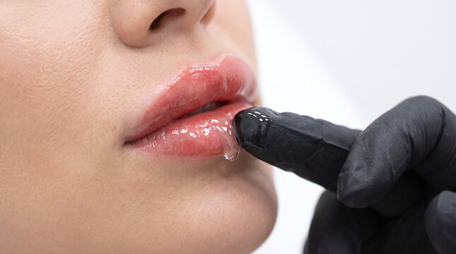 Beautician applying soothing healing gel on woman lips after cosmetic tattoo