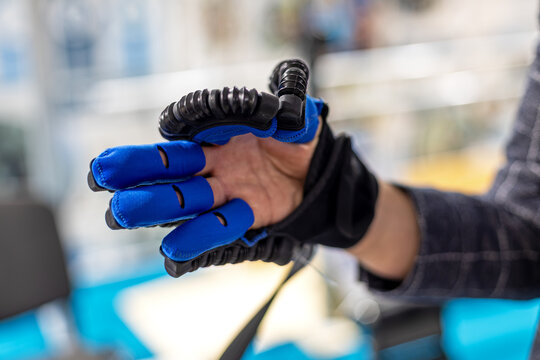 Close up of a robotic rehabilitation glove with blue finger supports and mechanical actuators, innovative wearable medical technology designed to assist hand movement and motor recovery.