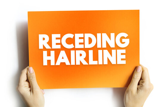Receding Hairline text on card held by hands, concept about hair loss, male pattern baldness, aging or self-care topics, isolated background for health or lifestyle design