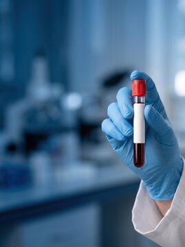 Blood sample in a test tube held by a gloved hand in a laboratory.