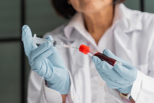 Mature Asian doctor put the patient's blood into a test tube