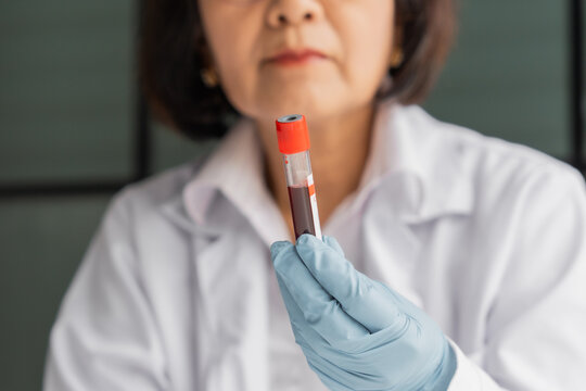 Mature Asian doctor examining patient's blood in test tube