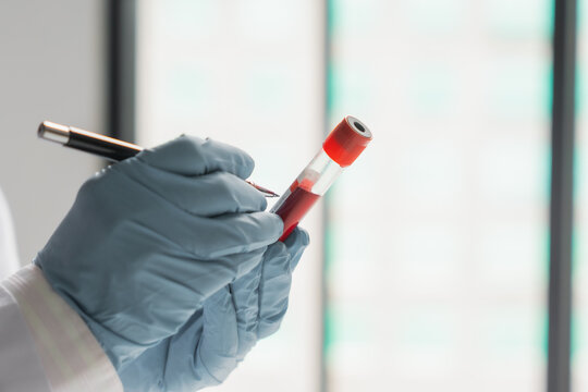 Mature Asian doctor write a label on patient's blood test tube
