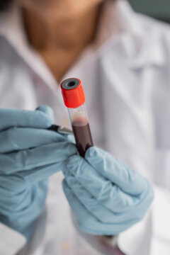 Mature Asian doctor write a label on patient's blood test tube
