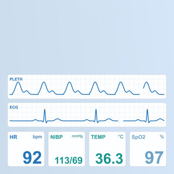 Interface d'&eacute;cran de moniteur de signes vitaux blanc clinique et bleu