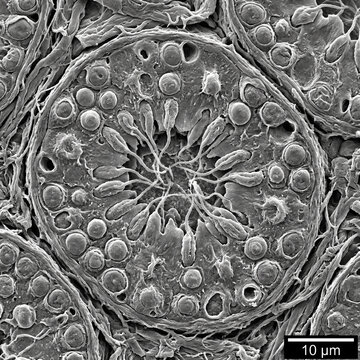cross-section of a human testis under scanning electron microscope (sem).