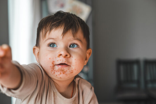 Baby with bright blue eyes reaches forward curiously. Face shows red spots from a mild rash or illness. Soft lighting highlights innocence and vulnerability. Image captures tender