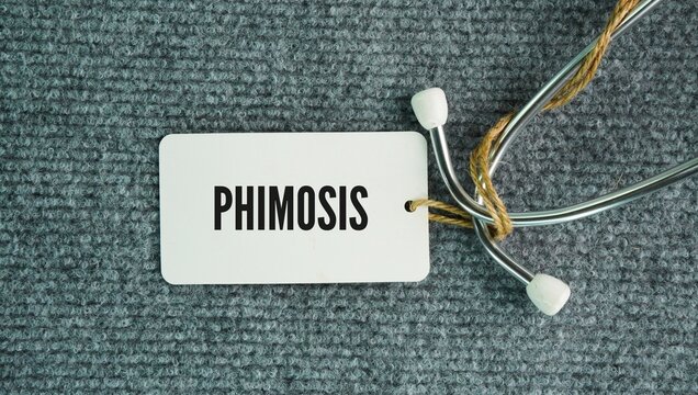 Stethoscope and paper tag with the word Phimosis is a medical condition in uncircumcised males where the foreskin is too tight to be pulled back retracted to expose the head glans of the penis.