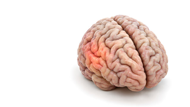 Dementia brain with cortical atrophy and neuroinflammation, photorealistic 3D medical illustration on white with copy space for neurology education, patient awareness and healthcare communication