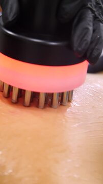 Professional body shaping therapy with vibromassage thermo vacuum and bioelectrical stimulation in beauty salon - vertical video
