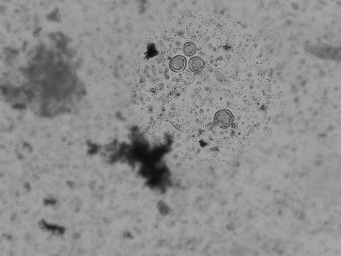 Microscopic image of human feces or stool showing Eggs (Ova) of taenia species. Eggs (Ova) of taenia species and bacteria in stool. 