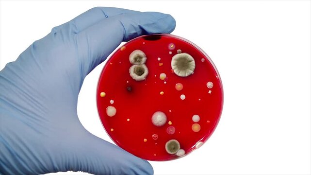 Mixed microbial colonies on blood agar, animated photograph. Gloved laboratory hand holding a culture plate with diverse fungal and bacterial colony morphology and pigmentation.