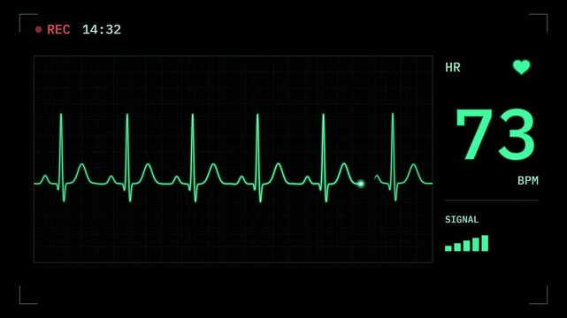 Digital ECG heart rate monitor recording overlay with glowing green heartbeat waveform, pulsing heart indicator, and changing bpm readout on transparent background. 4K