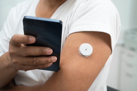 Asian woman with CGM continuous glucose sensor measuring blood sugar level patch for diabetes management.