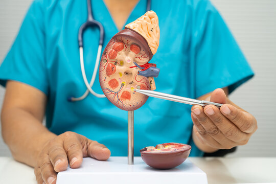 Chronic kidney disease, doctor with model for treatment urinary system, urology, Estimated glomerular filtration rate eGFR.