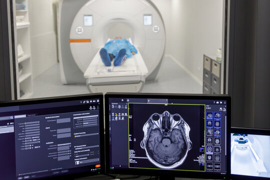 Advanced MRI control room showing brain scan results on monitors while a patient undergoes diagnostic imaging in a modern hospital clinic.