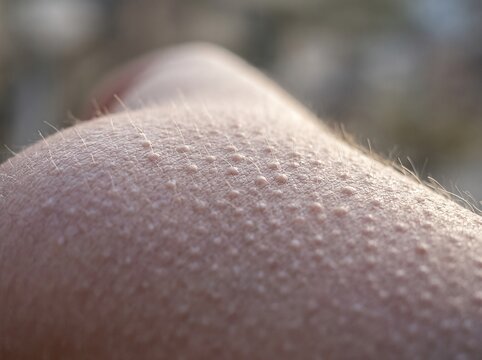 Close-up of goosebumps, a hair follicle reflex, against an isolated background