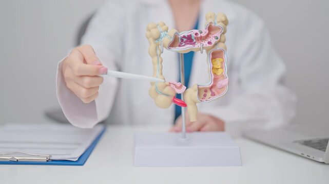 Doctor with human Colon anatomy model. Colonic disease, Large Intestine, Colorectal cancer, Ulcerative colitis, Diverticulitis, Irritable bowel syndrome, Digestive system and Healthcare concept