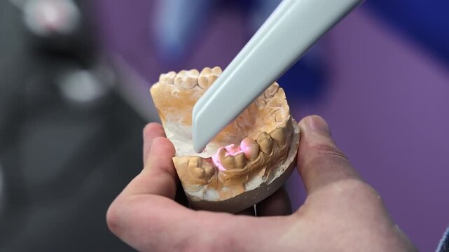 Handheld scanner shines purple light across a dental cast in a bright hall, Digital dentistry equipment captures the shape of model teeth indoors