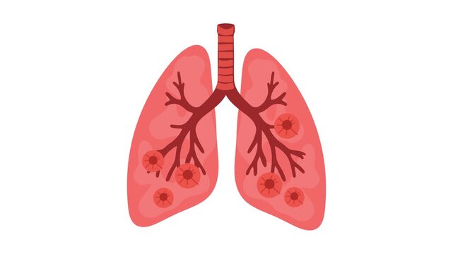 Animation of human lungs with bronchial tree structure in flat vector style