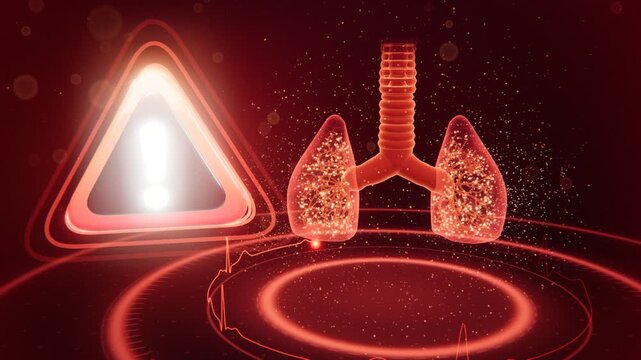 Anaphylaxis Warning 3D Allergic Reaction Allergens Hit Lungs Airway Swelling and Epinephrine Treatment
