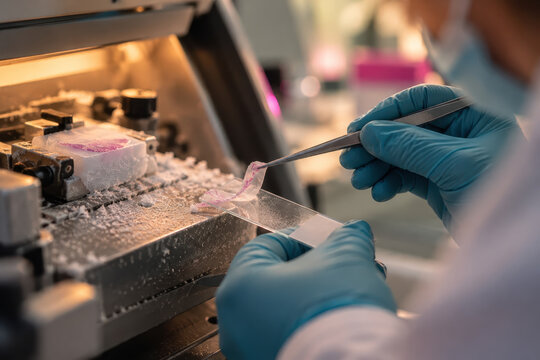 Blue-gloved hands lift and guide a thin tissue slice over the chilled specimen stage while working with the cryostat in a laboratory