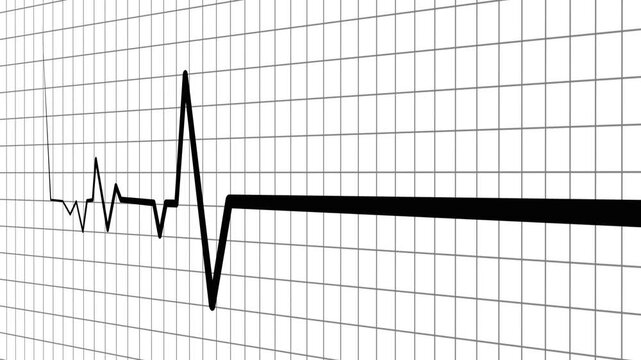 Heart beat line on graph paper showing an ecg pattern and medical signal animation