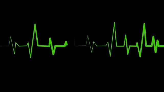 Heartbeat line on graph paper showing an ecg style rhythm pattern animation