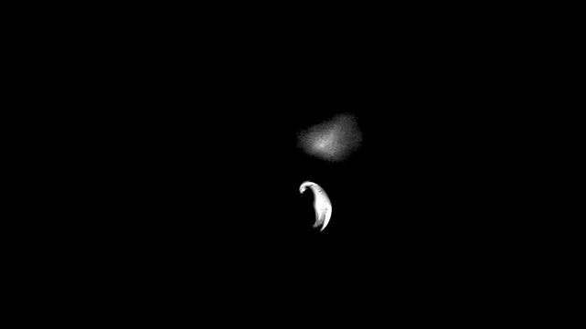 Stop Motion Series Of Gray Scale Magnetic Resonance Tomograms Showing Sagittal Sections Of Healthy Human Brain And Cranial Cavity