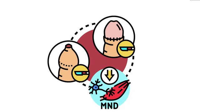 Prion disease concept presenting brain degradation, surgical intervention, and motor neuron damage, symbolizing complex neurological and degenerative health challenges